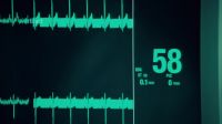 Burst suppression alpha coma