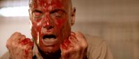 Have him stitched up!