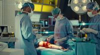 We have perfusion