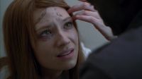 Why I have these marks on my forehead?
