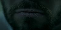 Your lips are chapped