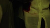 You're bleeding
