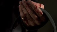 You're losing blood