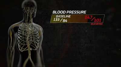147 over 101.
So definitely high. - Kings of Pain