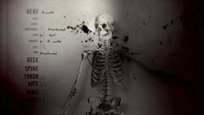A dreadful gash in his neck
scratched his windpipe, - Exterminate All the Brutes