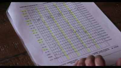 A normal EEG, - Dogs