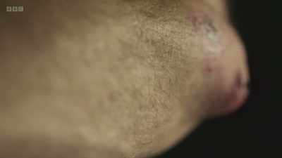 A slight wound in your skin
can be an entry point for deadly - The Human Body: Secrets of Your Life Revealed