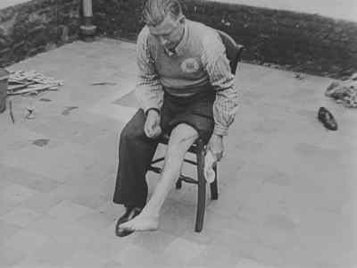 A victim shows scars caused
by repeated beatings. - Nazi Concentration Camps