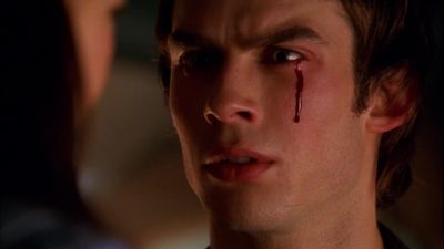 Adam, your eye. - Smallville