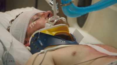 Advancing the balloon catheter
over the guide wire. - The Resident