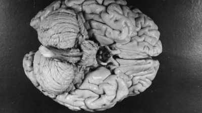 - After he had sectioned
the brain into, you know,
240 pieces or so, - The Man Who Stole Einstein's Brain