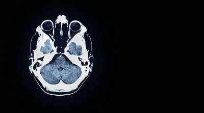 After multiple
neurological tests - Demon House