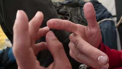 After trying so many times,
I've destroyed my fingers. - The Dawn Wall