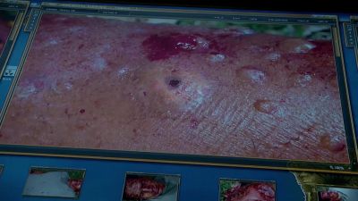 Ah, yes. This appears to be
an injection site. - Hawaii Five-0