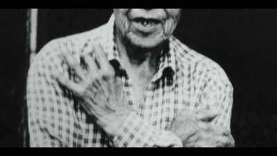 Albert Tate lost his fingers
in working accidents. - Surviving Death