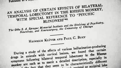 All of this, despite the fact that brain lesions - The Minds of Men
