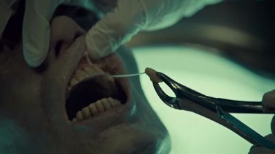 An accessory sinus
in the maxilla - Hemlock Grove