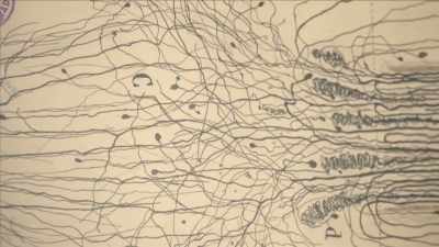 {\an1}Advances in dissection revealed - Mysteries of Mental Illness