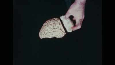 {\an1}attempt to change patterns of
communication was the lobotomy, - Mysteries of Mental Illness