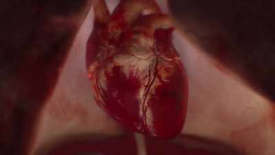 {\an1}But unlike a heart attack, - Human: The World Within