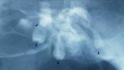 {\an1}HIGI: What appeared to be a
psychotic break - Mysteries of Mental Illness
