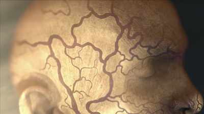 {\an1}In the late 1800s, - Mysteries of Mental Illness