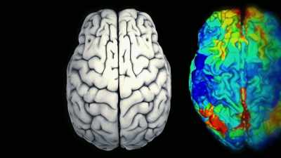 {\an1}Instead, it might be the complex
connections between regions, - Mysteries of Mental Illness