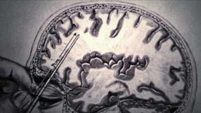 {\an1}Instead of accessing
the frontal lobe - Mysteries of Mental Illness