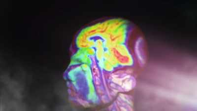 {\an1}MRIs and PET scans offer insight - Mysteries of Mental Illness
