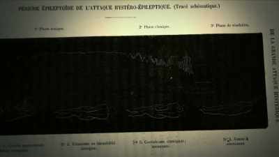 {\an1}NARRATOR: Charcot decided to use
a technique popular at the time: - Mysteries of Mental Illness