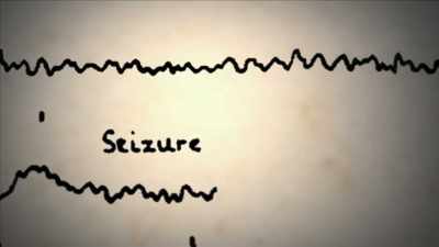 {\an1}produced the first recordings
of brain activity - Mysteries of Mental Illness