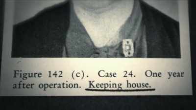 {\an1}SCULL: Because each operation
took an hour or two - Mysteries of Mental Illness