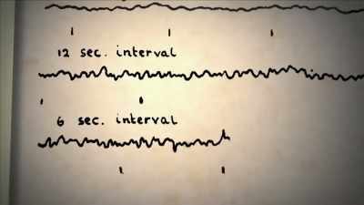 {\an1}the electroencephalograph,
or E.E.G... - Mysteries of Mental Illness