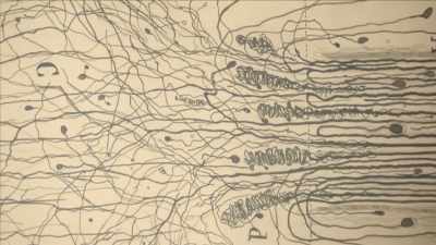 {\an1}Today, genetic breakthroughs
and neuroimaging - Mysteries of Mental Illness