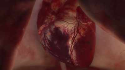 {\an1}When they die, scar tissue
grows in their place, - Human: The World Within