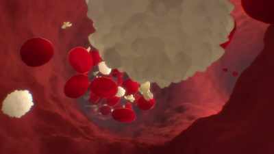 {\an1}When those arteries get
clogged up with fatty deposits, - Human: The World Within