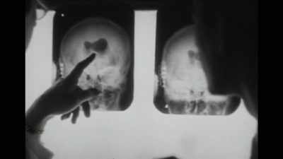 {\an1}X-rays, surgery, and even
autopsies provided few clues. - Mysteries of Mental Illness