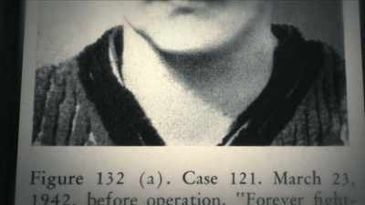 {\an7}MAN: Six centimeters
above the zygoma, - Mysteries of Mental Illness