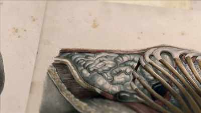 {\an7}NARRATOR: But then doctors
noticed a surprising connection. - Mysteries of Mental Illness