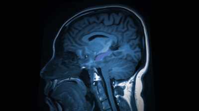 {\an7}NARRATOR: Yehuda's work shows
that trauma - Mysteries of Mental Illness