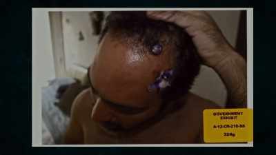 {\an8}...and the round marks on his head, - Cowboy Cartel