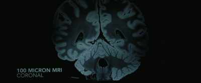 {\an8}They differ in frequency, - After Death