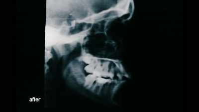 {\an8}We are talking
specifically about posture. - Open Wide