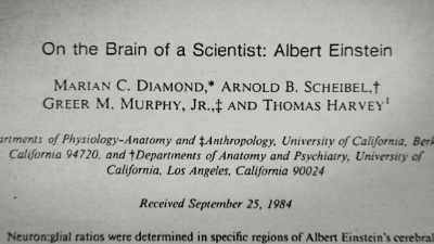 And she concludes that einstein
had more - The Man Who Stole Einstein's Brain