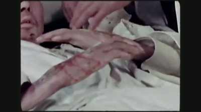 And we did a few
white blood counts - Hiroshima and Nagasaki: 75 Years Later