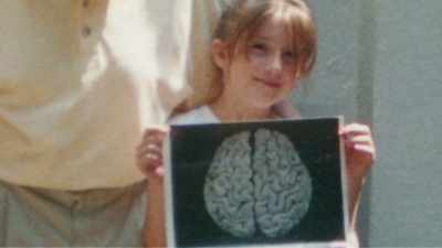 - And dr. Harvey, at that point, - The Man Who Stole Einstein's Brain