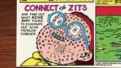 And find out what
Acne amy found to eliminate her - 30 Years of Garbage: The Garbage Pail Kids Story