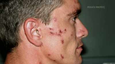 And he had meth sores
on his face, on his arms, and... - Floribama Murders