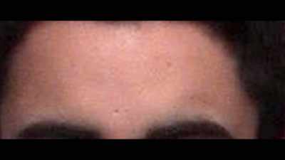 And how Michael Patryn has
a pockmark in the exact same spot. - Trust No One: The Hunt for the Crypto King