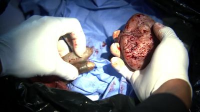 And human organs. - CSI: Crime Scene Investigation